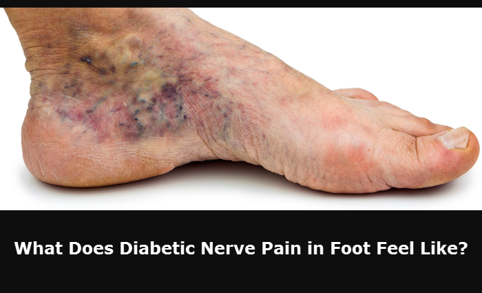 what-does-diabetic-foot-pain-feel-like-livingwithdiabetes-info